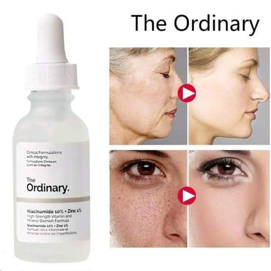 The Ordinary Niacinamide 10%+Zinc 1% t4trendz