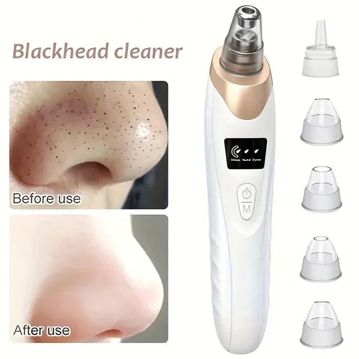 5-In-1 Rechargeable Suction Acne and Blackhead Remover for Men and Women t4trendz
